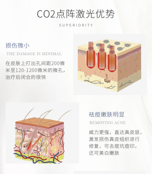 奢己co2二氧化碳剥脱点阵激光非剥脱单部位