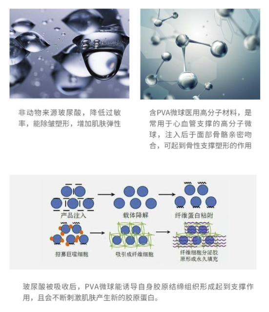 奢己宝尼达玻尿酸注射骨性填充05ml