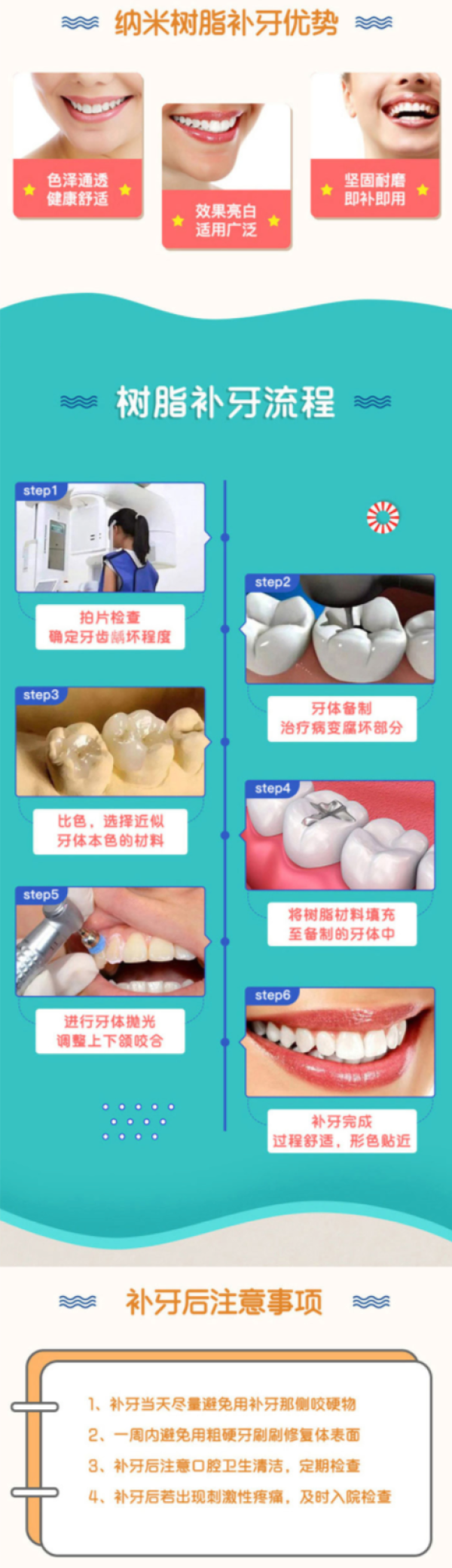 【省29元】广大口腔 美国3m树脂补牙 仅限首颗多少钱