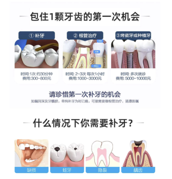 进口纳米树脂补牙套餐限购1份