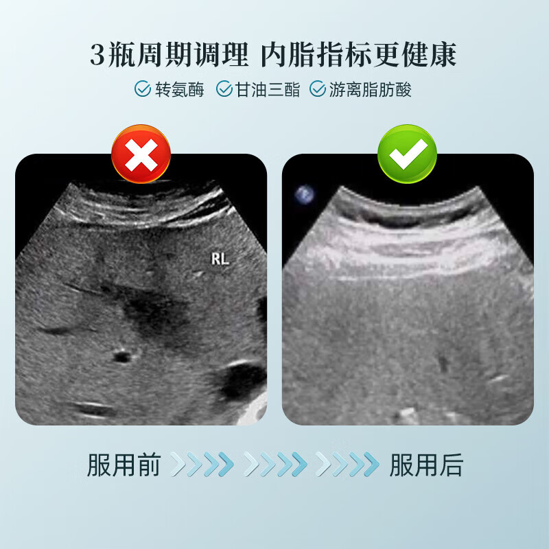 原知因肝立方护肝片降转氨酶脂胆固醇修复肝损适用脂肪肝酒精肝熬夜肝