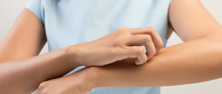  驱蚊止痒安逸一夏实用驱蚊产品推荐