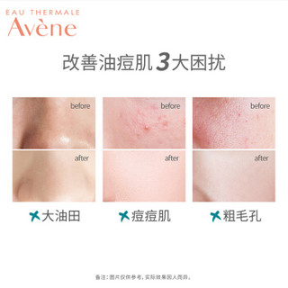 Avene 雅漾 控油清痘套组（控油精华洗面奶 男女通用 皮尔法伯集团 原装进口）