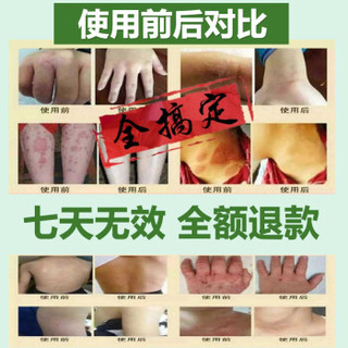 SHUNHAOTANG 顺浩堂 湿疹膏成人股藓膏大腿内侧皮肤瘙痒