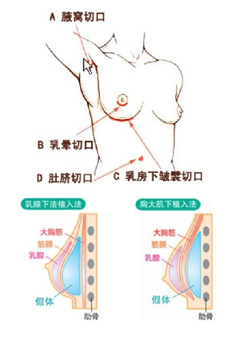 女性健康研究所：丰胸化吉，猪蹄不仅不能丰胸还会变胖哦~