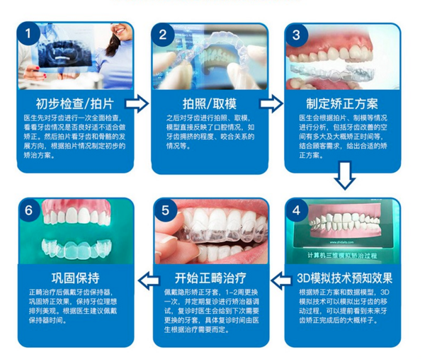 美奥口腔 正雅数字化隐形牙齿矫正 透明牙套正畸 龅牙地包天矫正方案