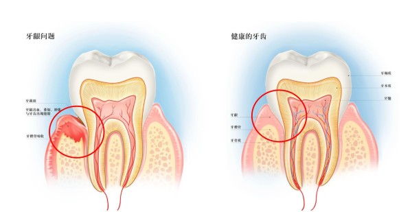 小编精选牙医推荐出血红肿口臭秒杀各种牙龈问题的牙膏专业选手