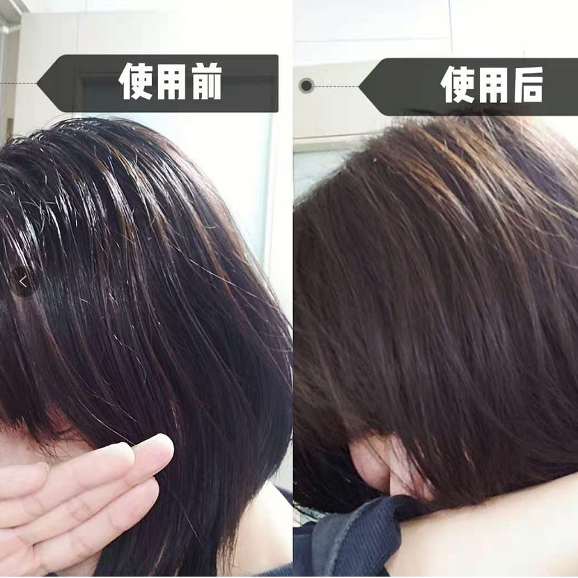 小编精选:能耐了!我的油头皮终于有救了~洗后发根蓬松清爽还止痒防脱