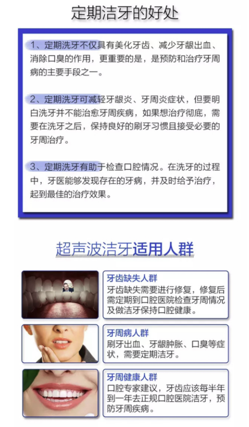 奢己 超声波洁牙 口腔清洁去除牙结石