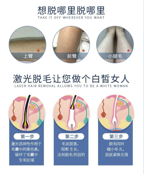 奢己激光脱毛 6选1 限首 多少钱 什么值得买