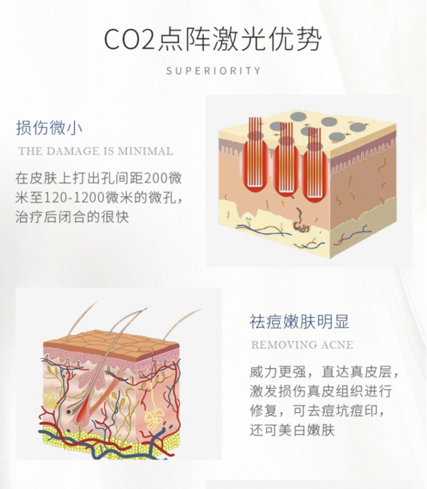 奢己  CO2二氧化碳剥脱点阵激光 非剥脱 单部位