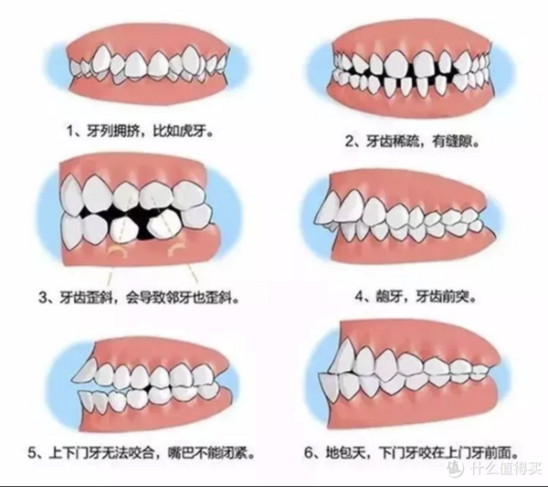 儿童牙齿矫正真的是小事？呵护牙齿我们是认真的