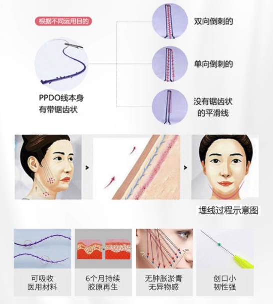 线雕示意图图片