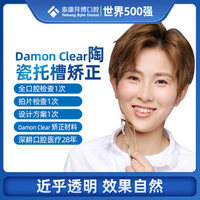 拜博口腔 Damon Clear陶瓷自锁托槽矫正