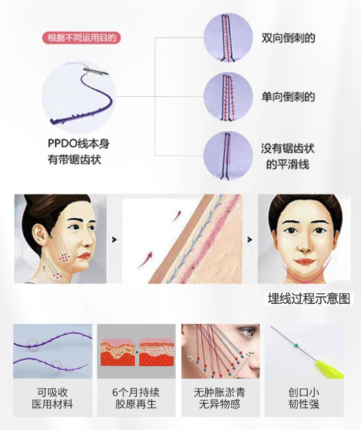 奢己 6D全面部埋线线雕提升紧致 单部位