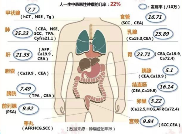 小编精选：没有想到体检时医生让我添加几项肿瘤标志物项目！