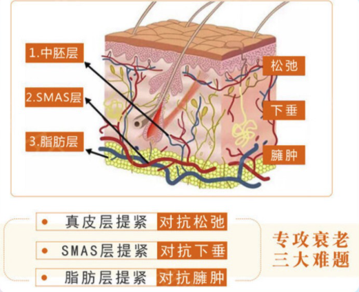 奢己 热拉提 以色列飞顿 单次/颈部200发