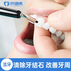 拼健康 单次洗牙洁牙抛光 去除牙结石