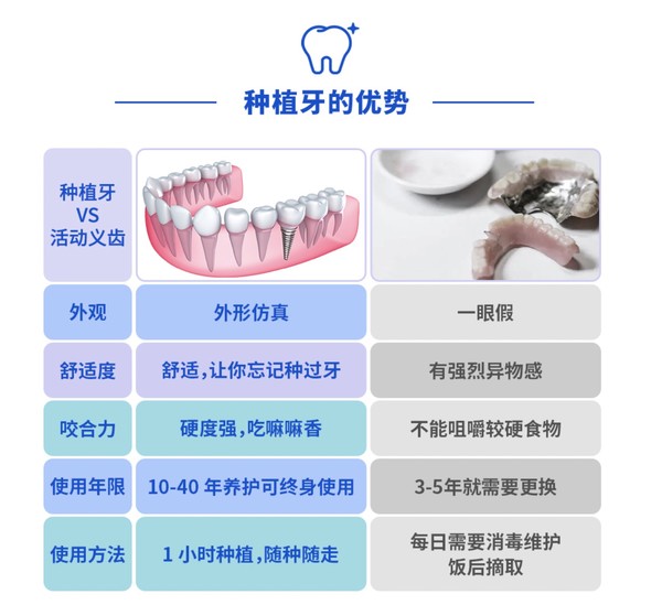 EnjoyDental 欢乐口腔 进口ABT种植牙套餐含基台牙冠