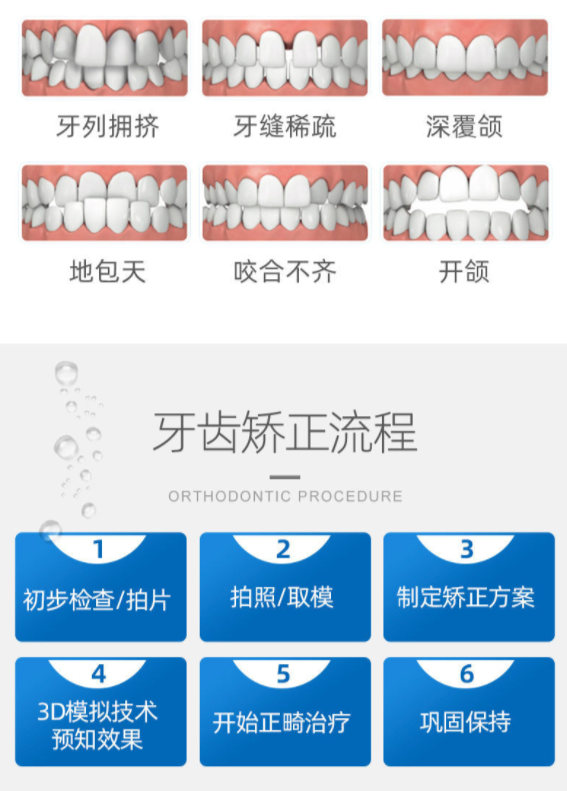 拼健康 美奥正雅隐形矫正(简单案例)