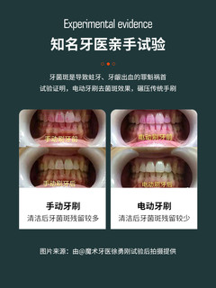 m-teeth/萌牙家星耀系列声波震动五档男女成人软毛电动牙刷情侣 X2 月光白（包装随机发，介意勿拍）