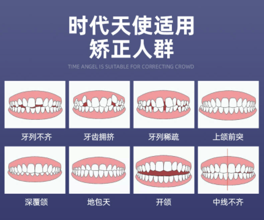 时代天使隐形矫正标准套餐（单模）