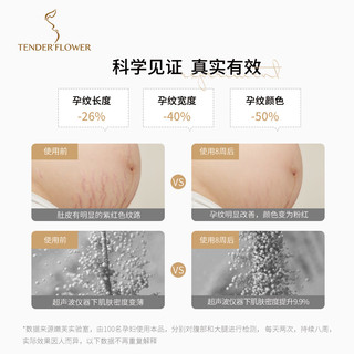 德国嫩芙叶酸孕妇专用孕纹精华乳妊娠期纹路保湿身体乳保湿修护霜