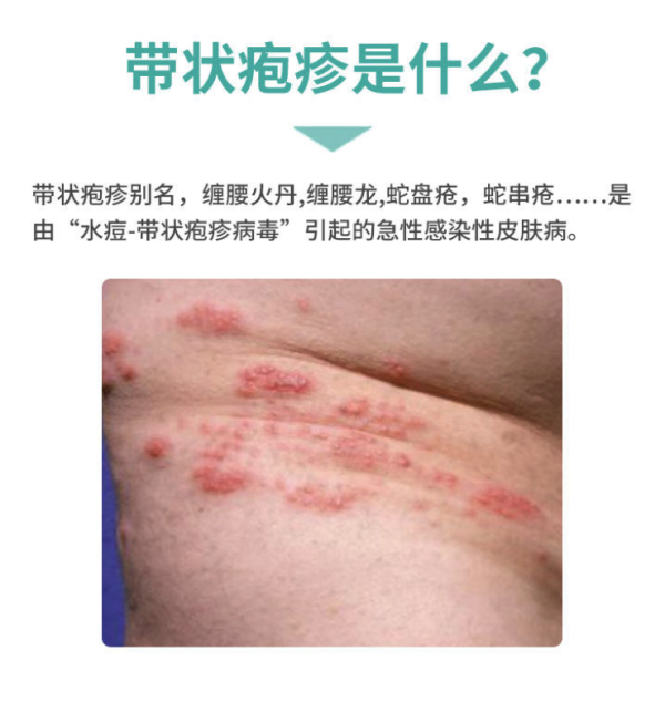 带状疱疹疫苗生蛇全国预约代订