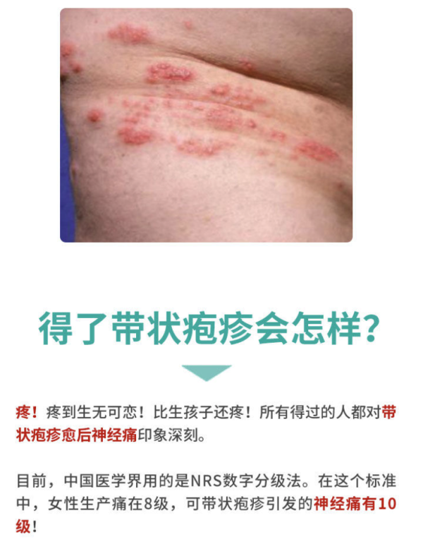 是由"水痘-带状疱疹病毒"引起的急性感染性皮肤病.