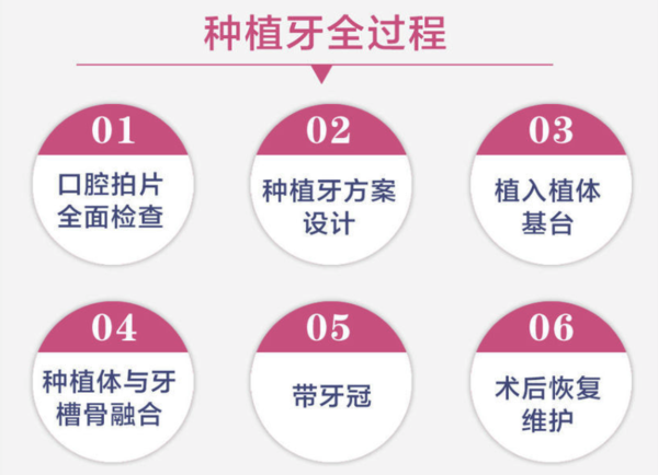 彩虹医生 全口半口固定种植牙