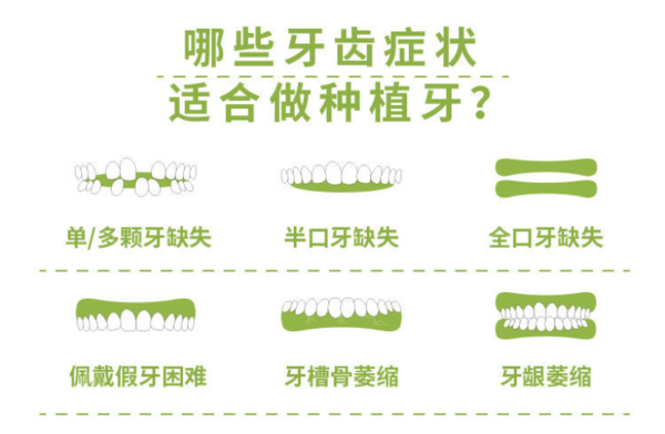 限上海：英博口腔 韩国进口种植牙套餐