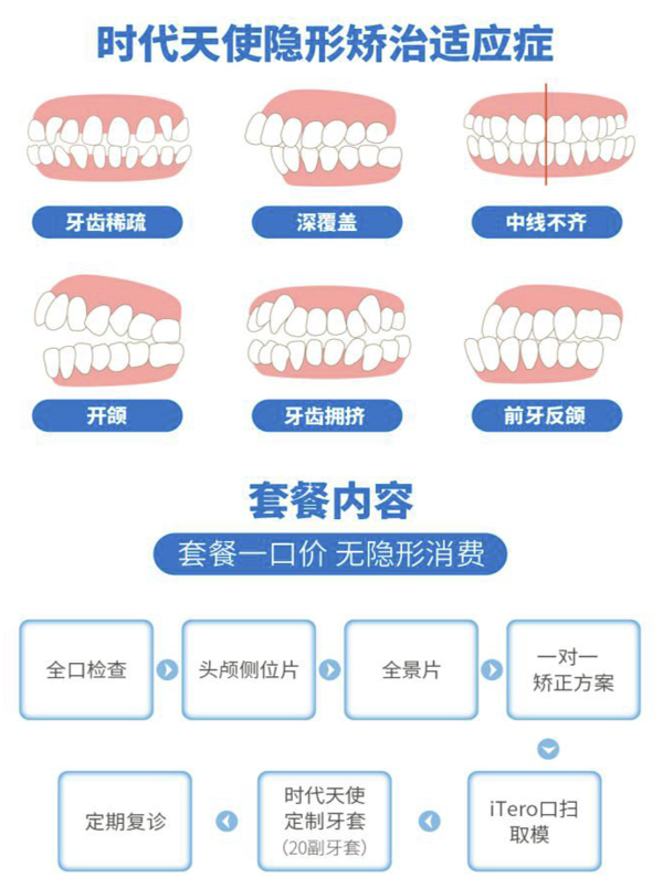 EnjoyDental 欢乐口腔 IDSO优选 时代天使矫正套餐