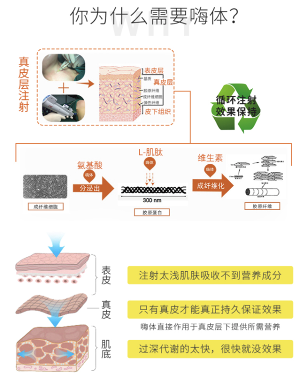 嗨体去颈纹 嗨体1.5ML+2.5ML套餐