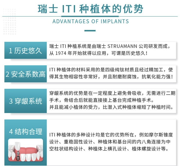牙管家 瑞士iti种植牙