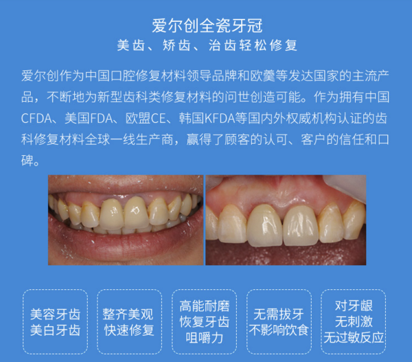 爱尔创 全瓷牙冠