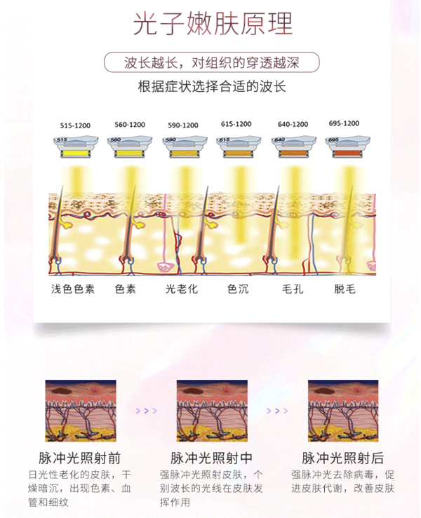 M22光子嫩肤  3次卡