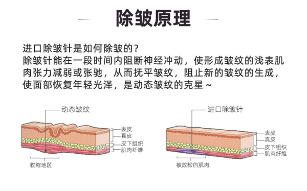 美国进口除皱 【限购3】