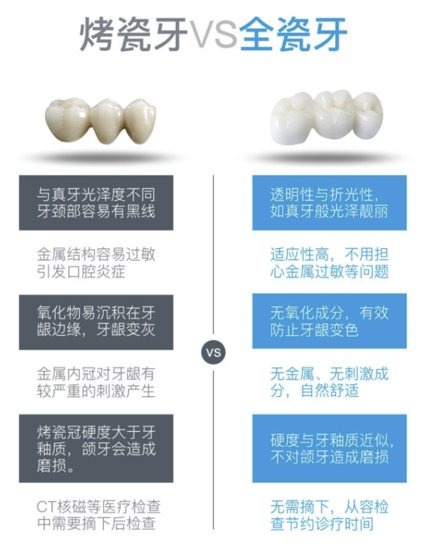 DALEK 二氧化锆3M拉瓦全瓷牙