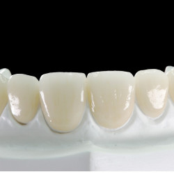 dalek戴立克二氧化锆爱尔创全瓷牙