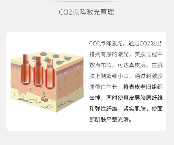 面部皮肤管理 Co2二氧化碳剥脱单部位 限首单 多少钱 什么值得买