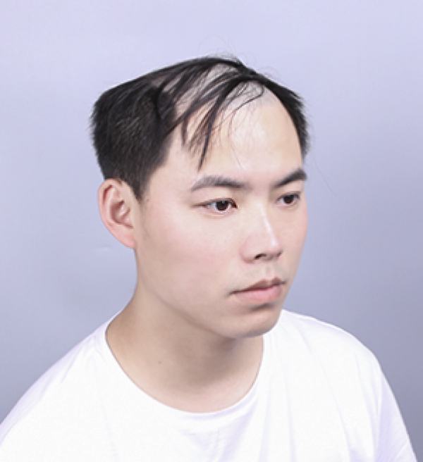 男士假发_眉俏 全真发 男士补发片(14*14cm)多少钱-什么值得买