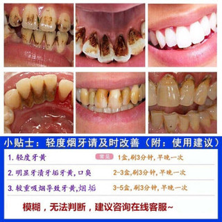 南京同仁堂 牙膏美白牙膏去茶渍牙膏牙渍牙垢黄牙牙齿护牙龈白牙口腔异味牙齿敏感男士专用 一 支