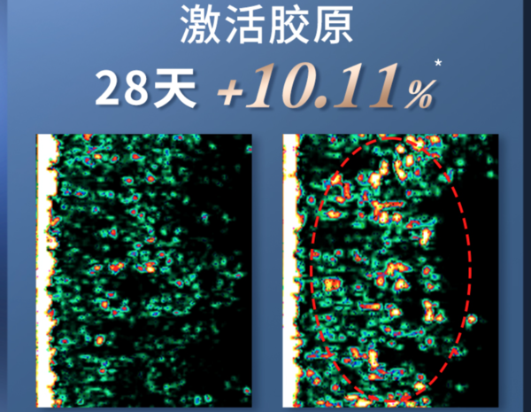 《选型号》vol.15 热销美容仪怎么选不踩坑？全型号解读！30岁宝妈抗老经验分享