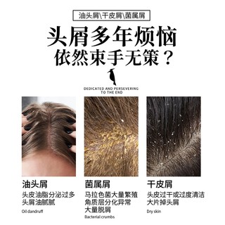 RACLEN 雨洁 啄木鸟去屑洗发水啄屑王洗头膏男女士止痒控油洗发露清爽持久留香蓬松氨基酸护发液