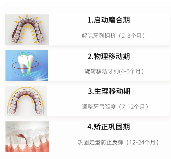 SMILEHERO 隐形牙齿矫正器上牙一期【需要先取模】