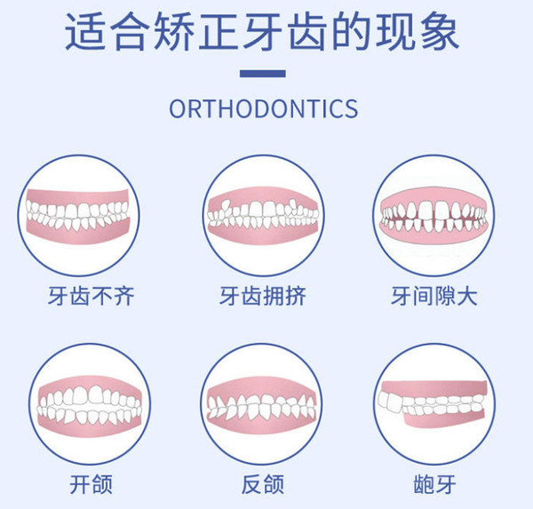 SMILEHERO 隐形牙齿矫正器【全套矫正服务】取模+动画+矫治器+保持器+售后