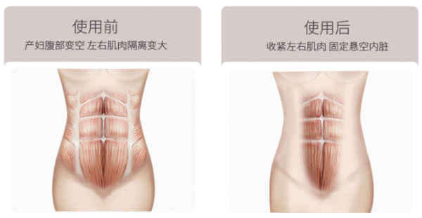 XIJIAN 汐健 产妇顺产专用收腹带