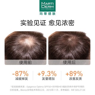 MARTIDERM 防脱发安瓶精华3ml*14支 (效期到2024/3/1)