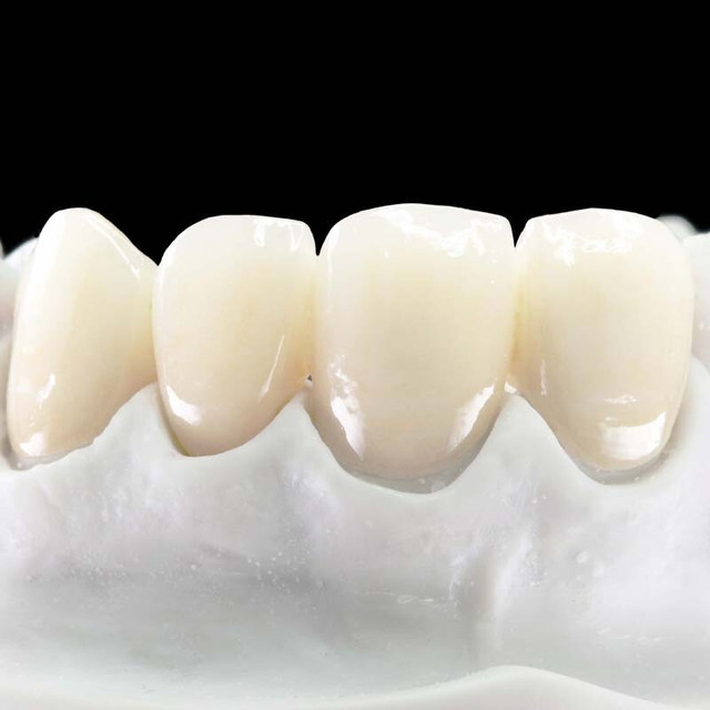 DALEK 泽康二氧化锆全瓷牙
