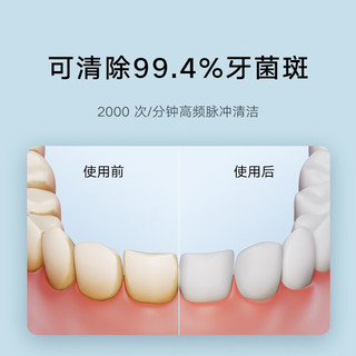 小米（MI）米家立式便携式冲牙器F300洗牙器水牙线4档模式3种喷嘴全身水洗预防蛀牙附带正畸喷嘴240ML大水箱 米家电动冲牙器F300薄荷绿